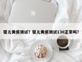 婴儿黄疸测试？婴儿黄疸测试130正常吗？