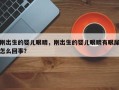 刚出生的婴儿眼睛，刚出生的婴儿眼睛有眼屎怎么回事？